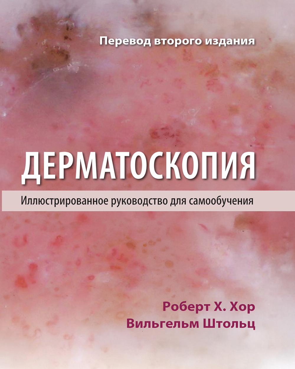 Дерматоскопия. Иллюстрированное руководство для самообучения