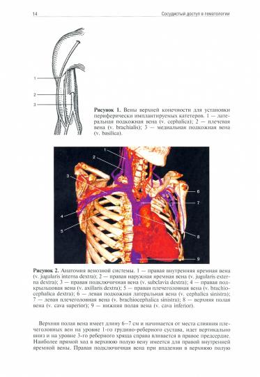 Сосудистый доступ в гематологии