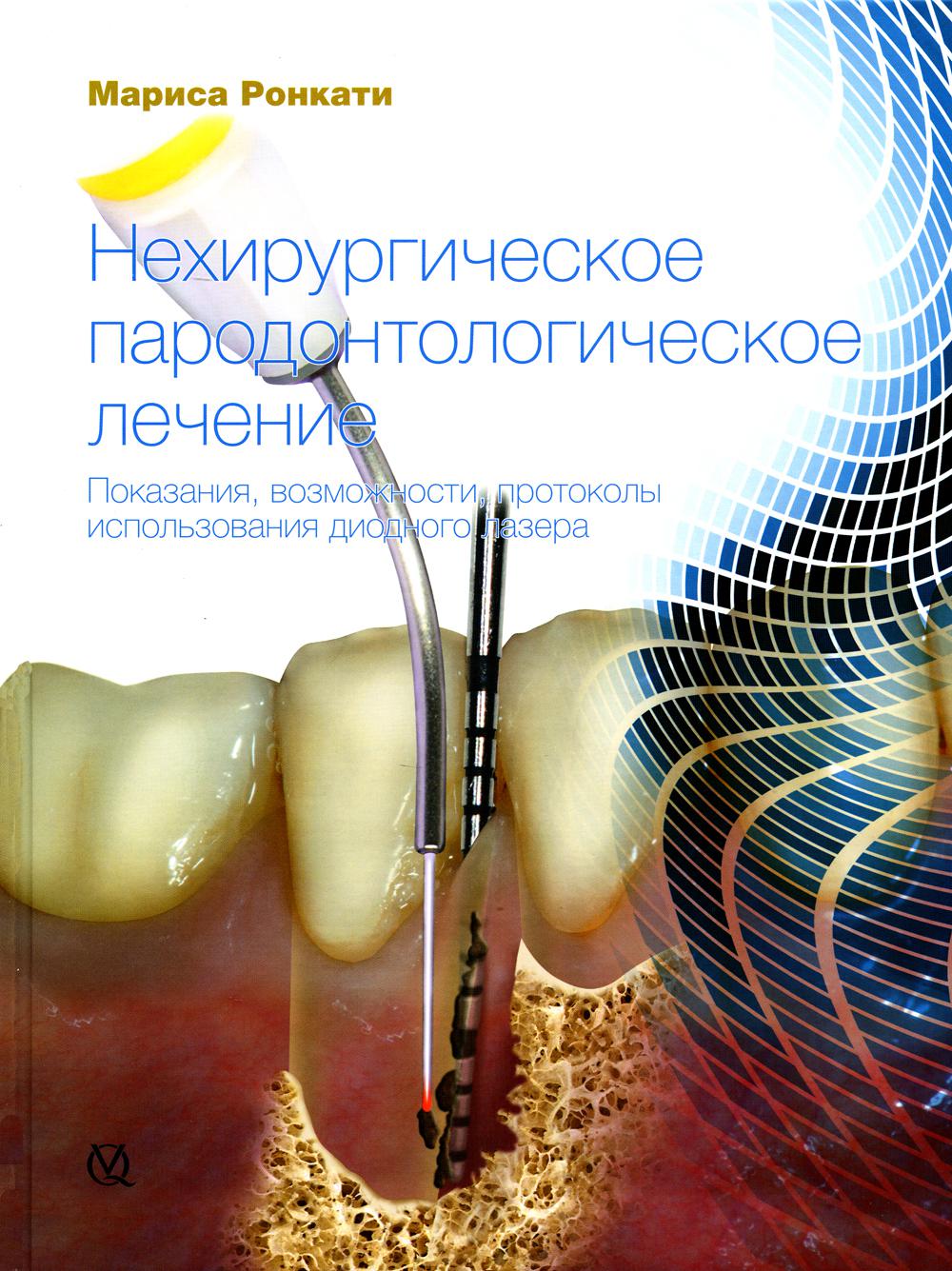Ронкати, М.Нехирургическое пародонтологическое лечение.Показания, возможности, протоколы использования диодного лазера./м.Ронкати; пер.с англ. -М.: ОО