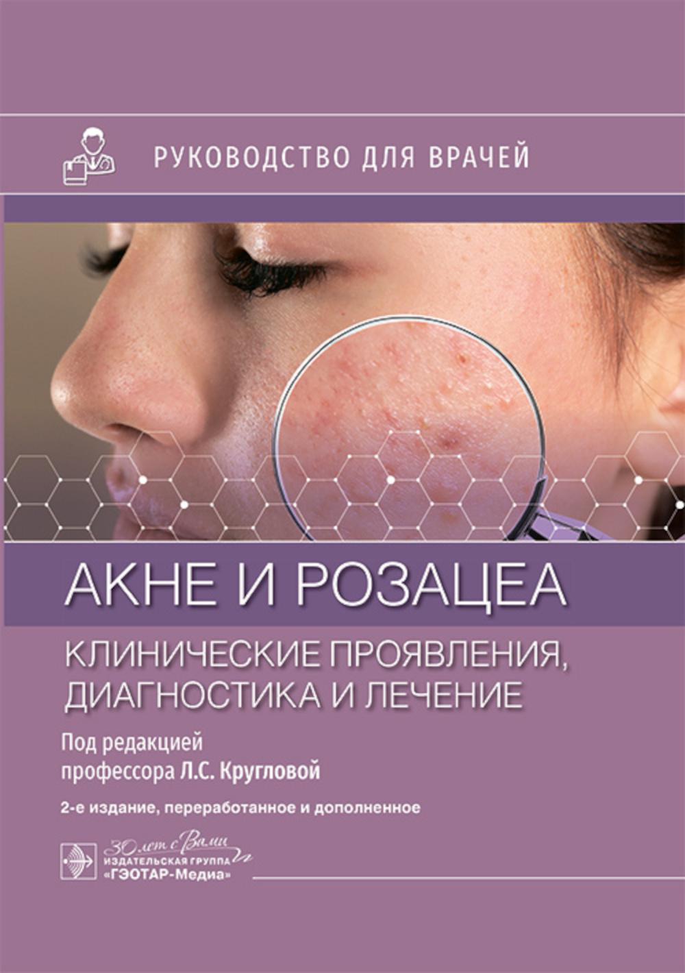 L'acné et la rose. Procédures cliniques, diagnostics et soins : procédures pour la maison. 2-е изд., перераб. je suis d'accord