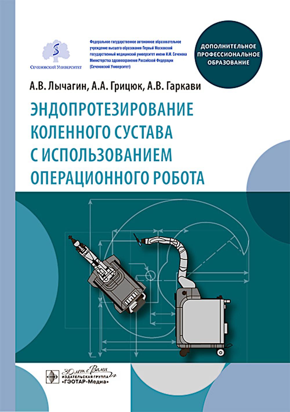Optimisation du fonctionnement du robot en utilisant le robot :