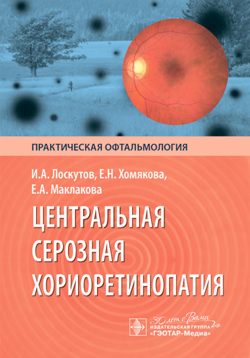 Центральная серозная хориоретинопатия / И. A. Лоскутов, Е. H. Хомякова, Е. A. Maklakova. — Москва : ГЭОТАР-Медиа, 2024. — 144 с. : IL. — (Серия «Практическая офтальмология»)