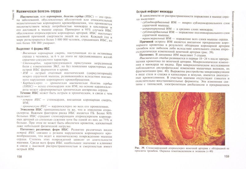 Anatomie pathologique et physiologie pathologique : Учебник. Пауков В.С., Литвицкий П.Ф.