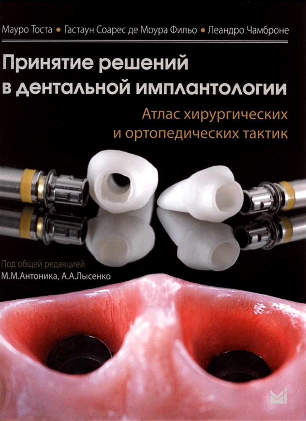 Réparation principale en implantologie dentaire. Tactiques chirurgicales et orthopédiques d'Atlas