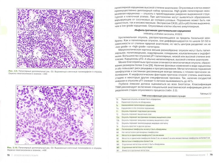 Опухоли мочевыделительной системы и мужских половых органов. Морфологическая диагностика и генетика: Руководство для врачей. 2-е изд., доп. Андреева Ю.Ю.