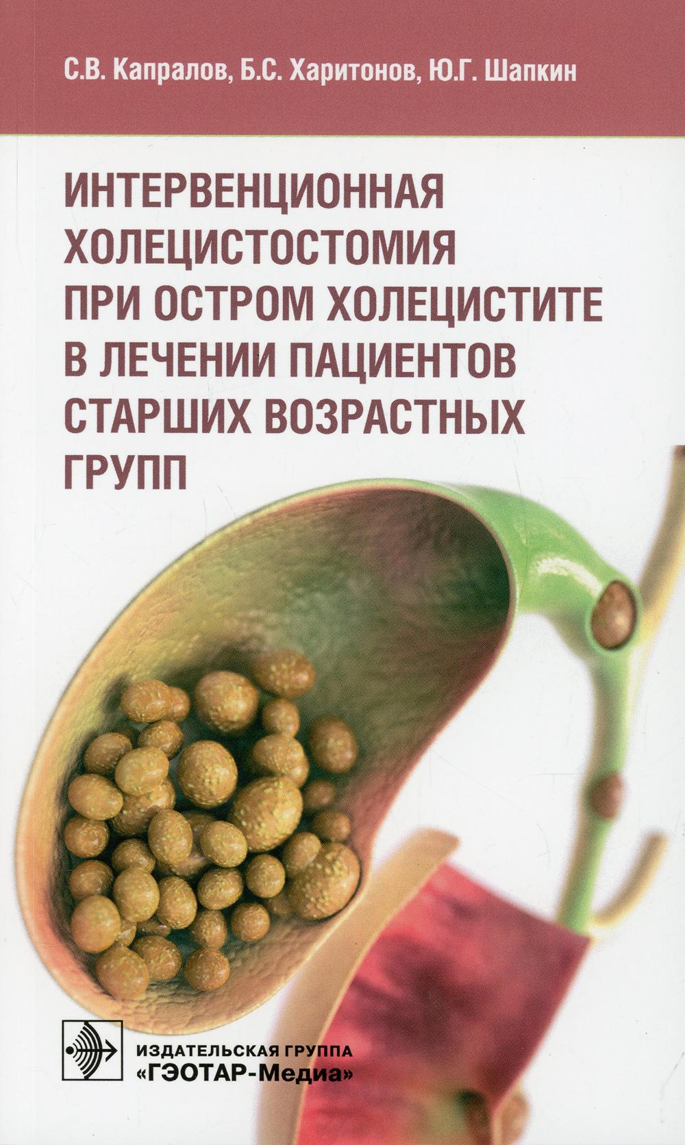 Интервенционная холецистостомия при остром холецистите в лечении пациентов старших возрастных групп / С. В. Капралов, Б. С. Харитонов, Ю. Г. Шапкин. — Москва : ГЭОТАР-Медиа, 2022. — 128 с. : ил.