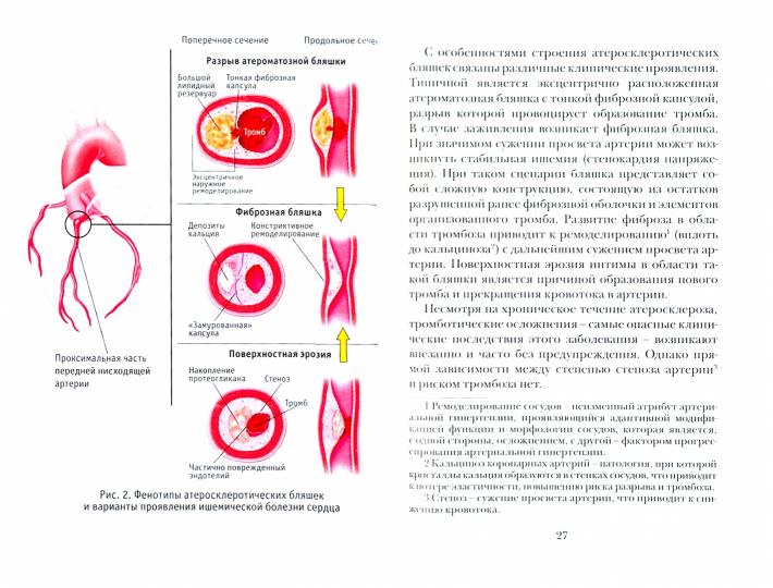 Sergei Yusin «Внезапная сердечная смерть в жизни каждого». Санкт-Петербург : Лимбус Пресс, ООО «Издательство К. Тублина», 2021. – 160 с., ил.