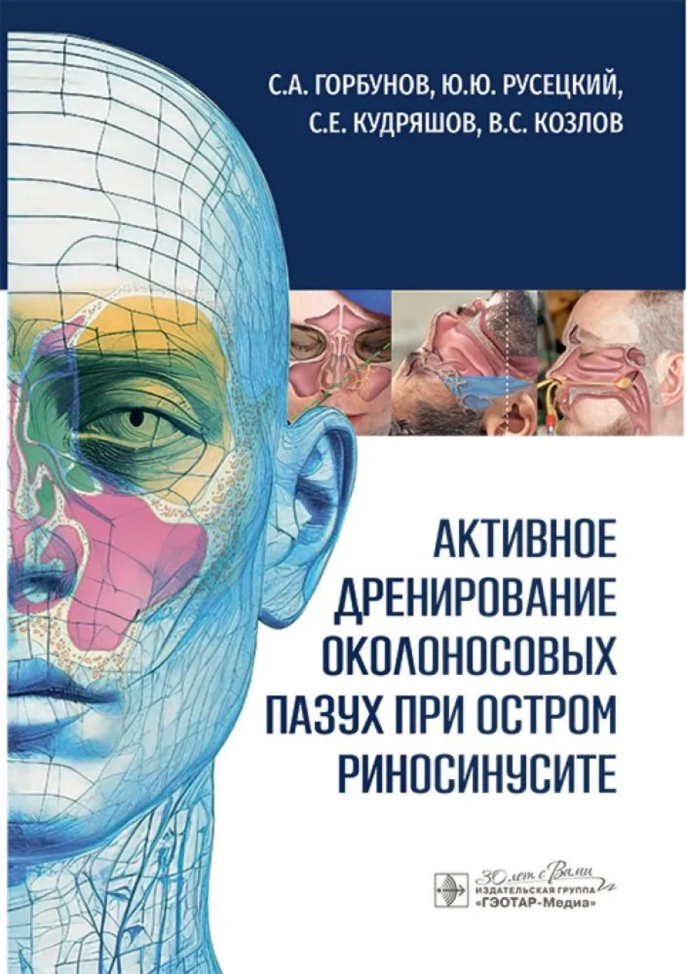 Активное дренирование околоносовых пазух при остром риносинусите / С. A. Горбунов, Ю. Ю. Русецкий, С. Е. Кудряшов, В. C. Kozlov. — Москва : ГЭОТАР-Медиа, 2025. — 168 с. : IL.