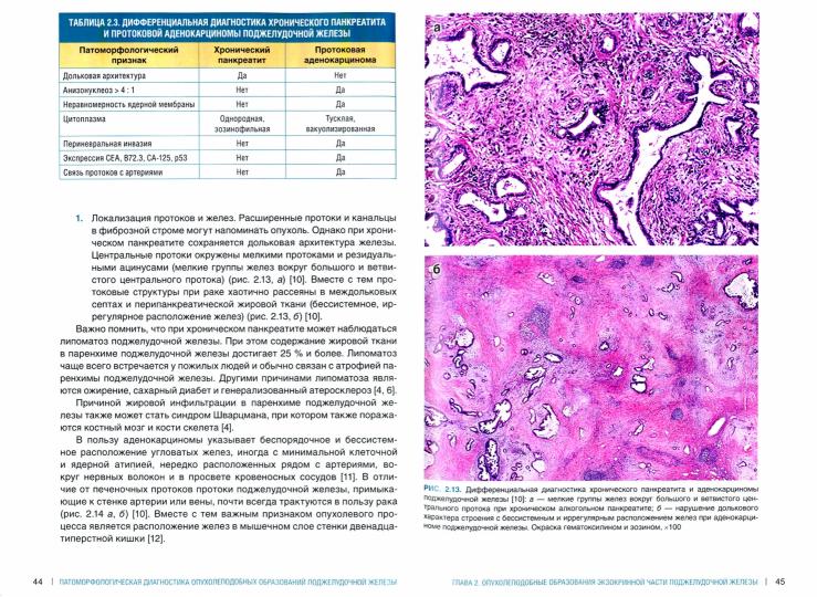 Le diagnostic pathologique est le plus approprié. Руководство для врачей***