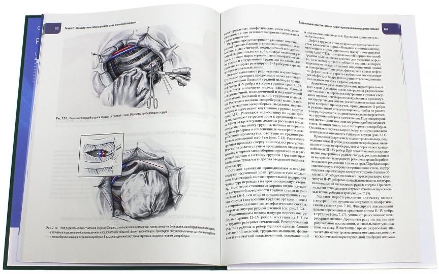 Атлас операций при злокачественных опухолях молочной железы. Сарибекян Э.К., под ред. Каприна А.Д., Трахтенберга А.Х., Чиссова В.И.