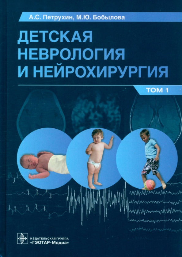 Детская неврология и нейрохирургия: учебник : в 2 т. / A. C. Петрухин, М. Ю. Бобылова и др. — Москва : ГЭОТАР-Медиа, 2023. — Т. 1. — 400 s. : IL.