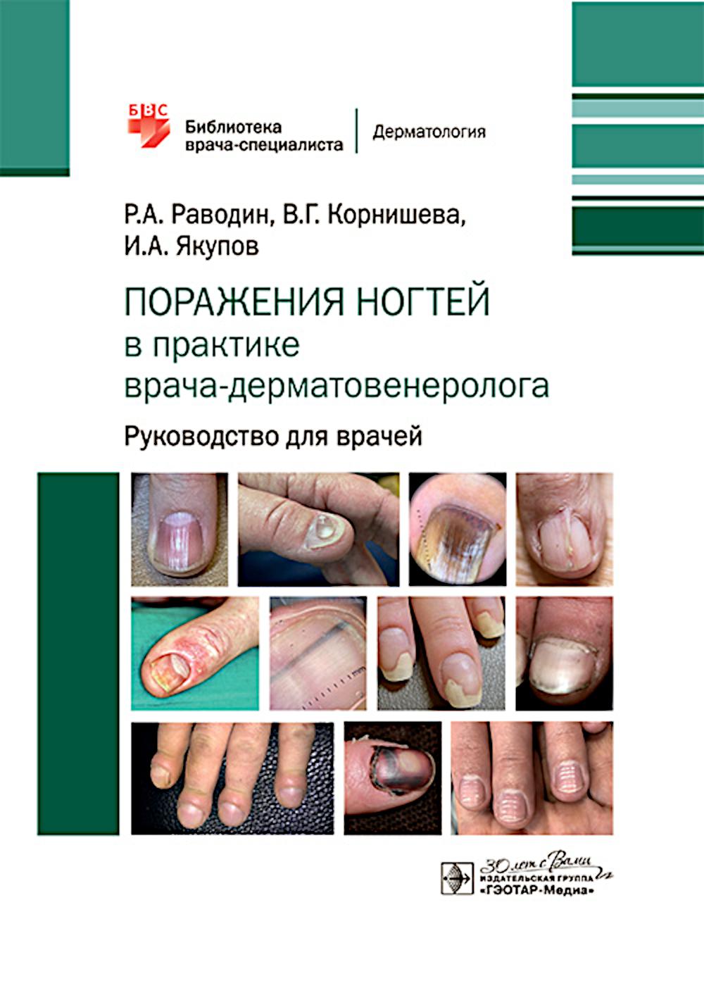 Поражения ногтей в практике врача-дерматовенеролога : руководство для врачей / Р. A. Раводин, В. Г. Корнишева, И. A. Якупов. — Москва : ГЭОТАР-Медиа, 2025. — 176 с. : IL. — (Серия «Библиотека врача-специаlistа»).