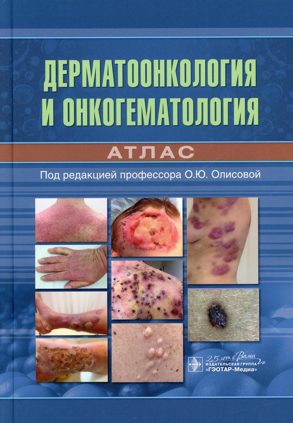 Dermatologie et oncogématologie. Atlas / под ред. О. Ю. Олисовой. — Москва : ГЭОТАР-Медиа, 2020. — 144 с. : IL. —DOI : 10.33029/9704-5413-8-DOA-2020-1-144.