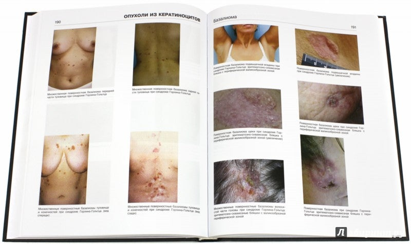 Dermatologie. Atlas. Молочков А.В., Молочкова Ю.В.