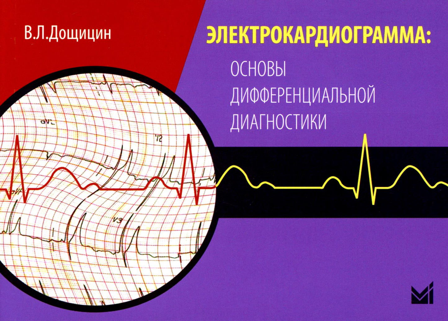 Électrocardiogramme : diagnostics différentiels précis. 2-e jour