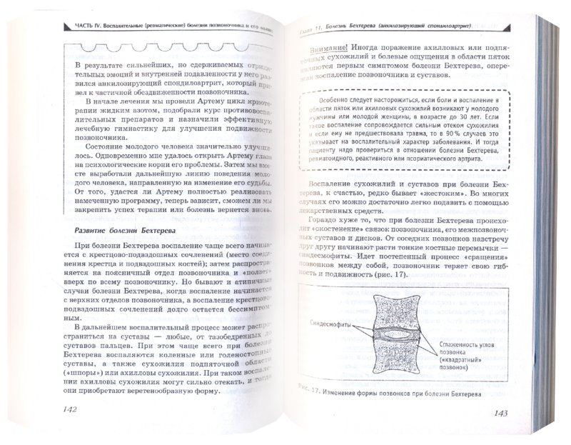 Боль в спине и шее. Qu'est-ce que tu dois faire pour ton travail.