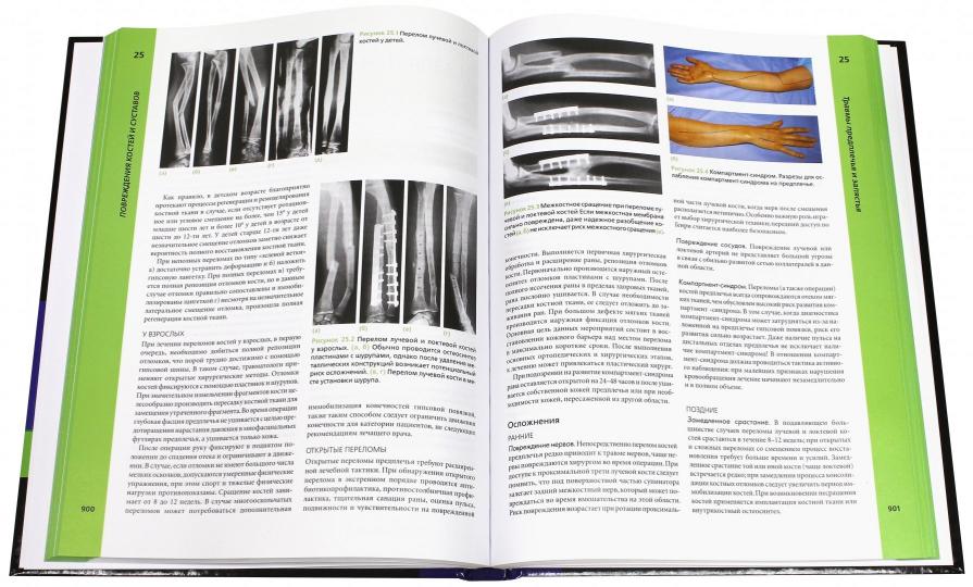 Ортопедия и травматология по Эпли. Руководство. В 3-х частях. Partie 3 : Coûts et coûts améliorés