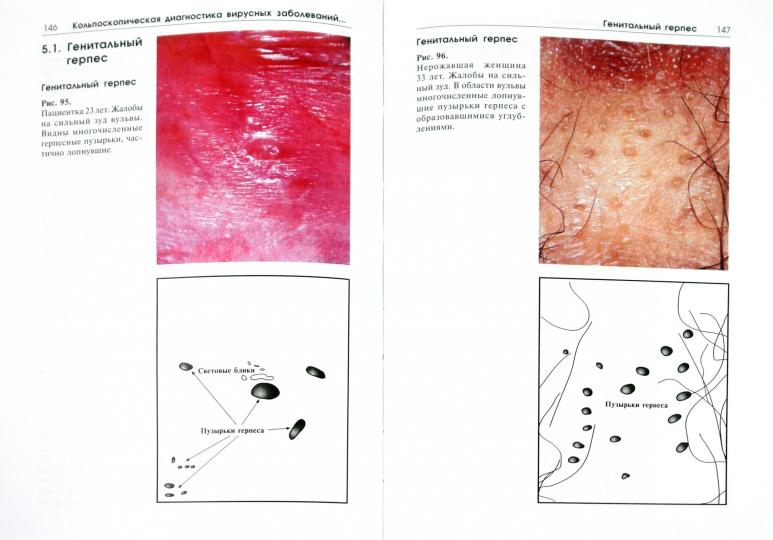 Цветной atlas по кольпоскопии: рук.Бауэр Г.