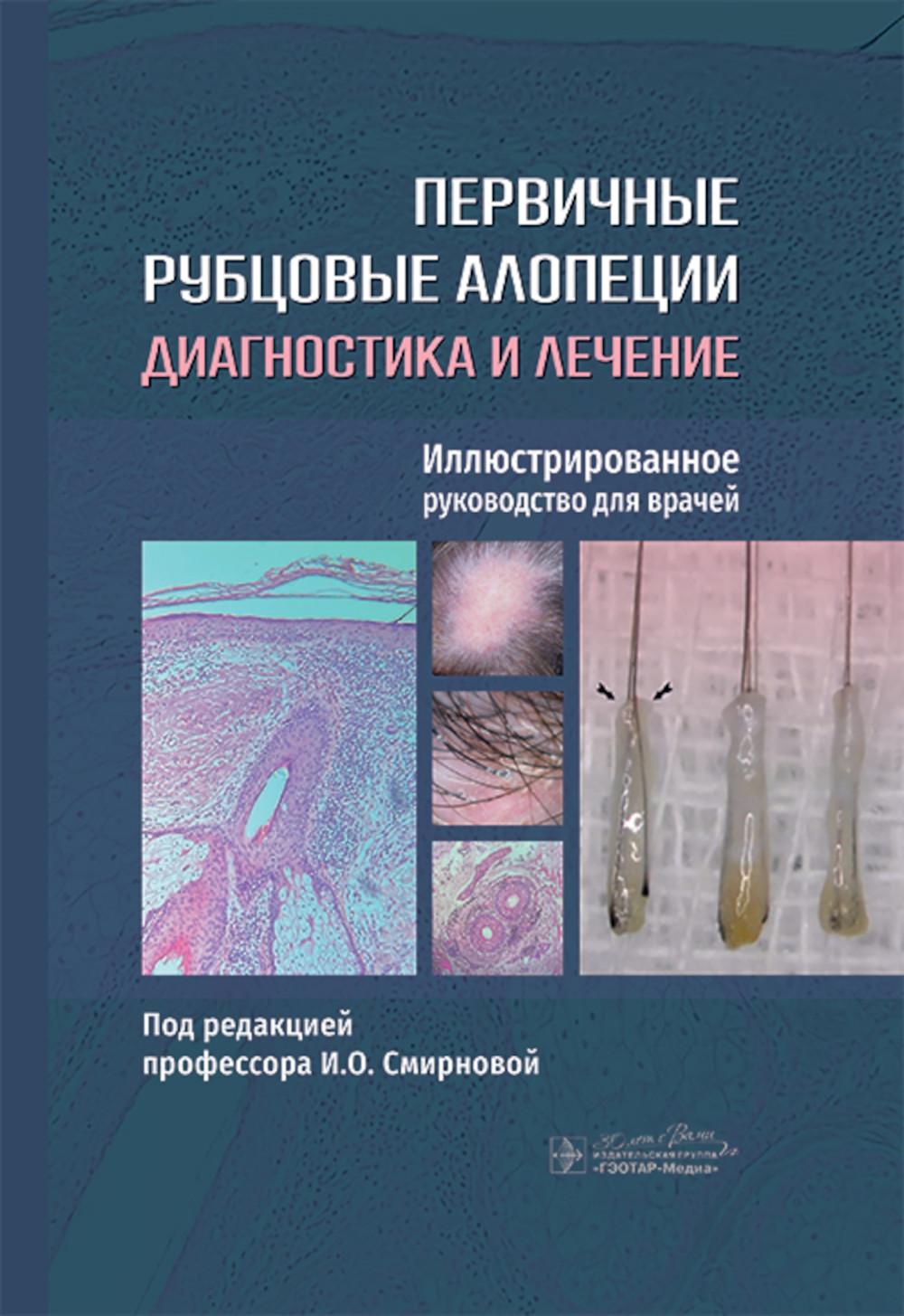 Первичные рубцовые алопеции: диагностика и лечение : иллюстрированное руководство для врачей / под ред. И. О. Смирновой. — Москва : ГЭОТАР-Медиа, 2025. — 296 с. : IL.