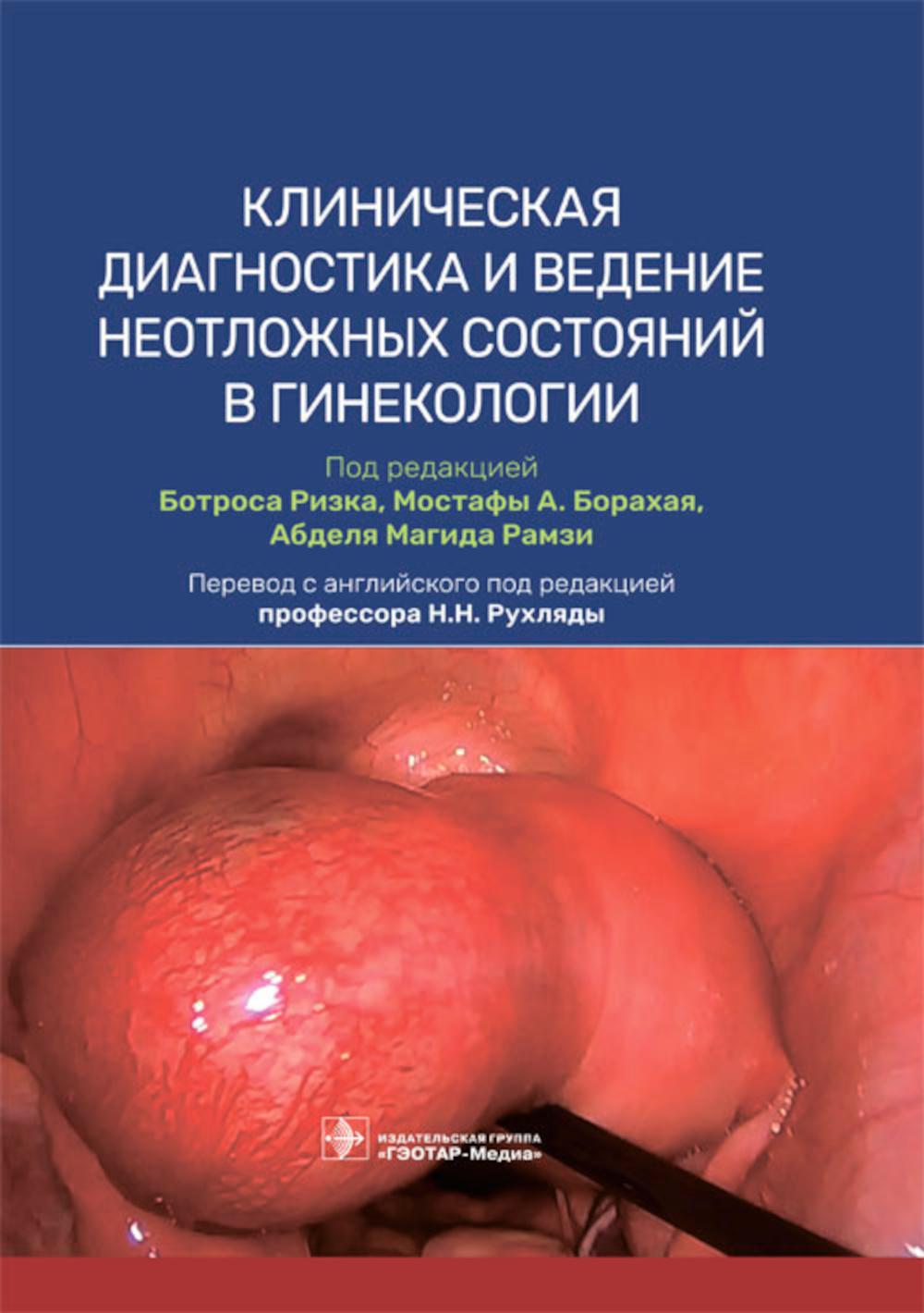 Diagnostic clinique et assistance médicale en gynécologie / sous-révision. Б. Ризка, М. A. Борахая, А. M. Ramzi ; par. с англ. под ред. H. H. Рухляды. — Москва : ГЭОТАР-Медиа, 2023. — 304 с. : IL.