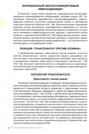 Interprétation de la biopsie en pédiatrie