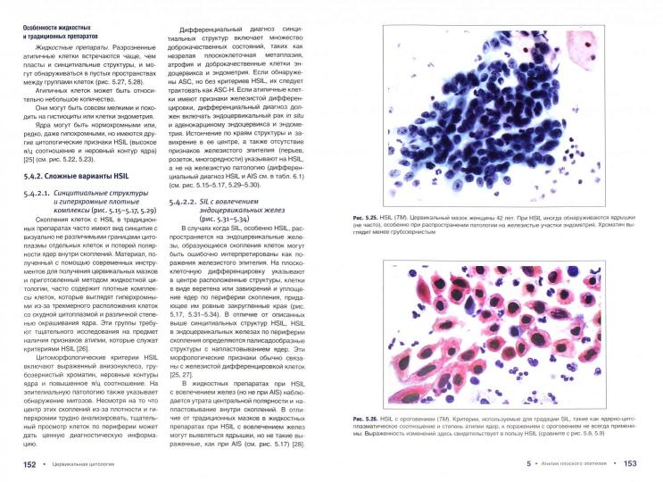 La cytologie cervicale du système Betesda. Terminologie, critères et spécifications