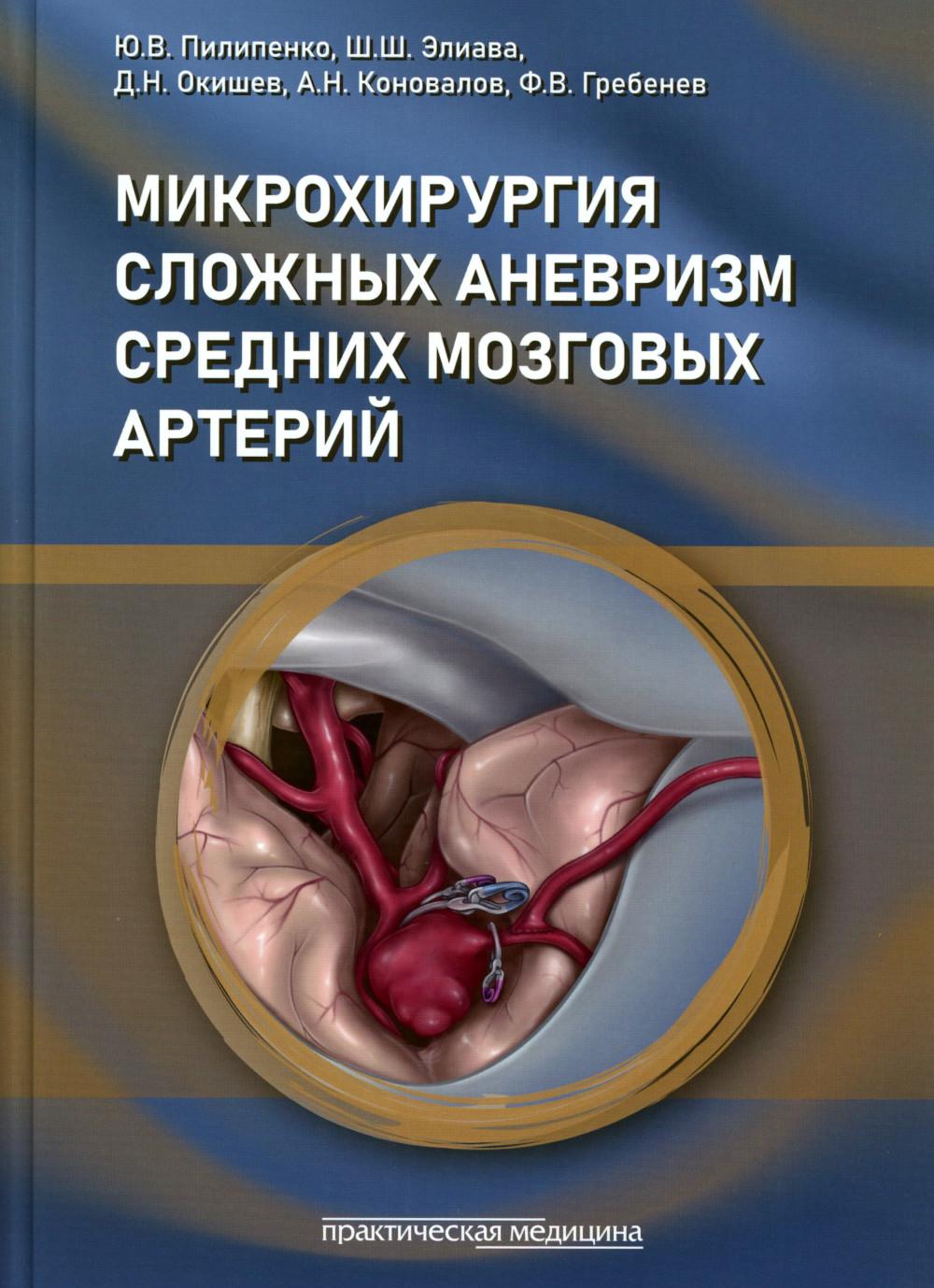 Microchirurgie des anévrismes de l'artère moscovite : grosses, géantes, fusifformes et graves