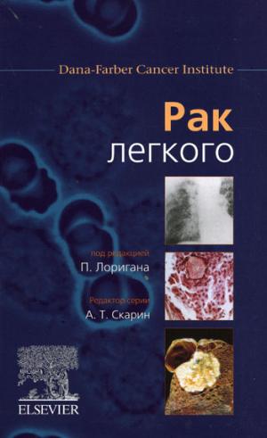Рак легкого. Перевод с английского