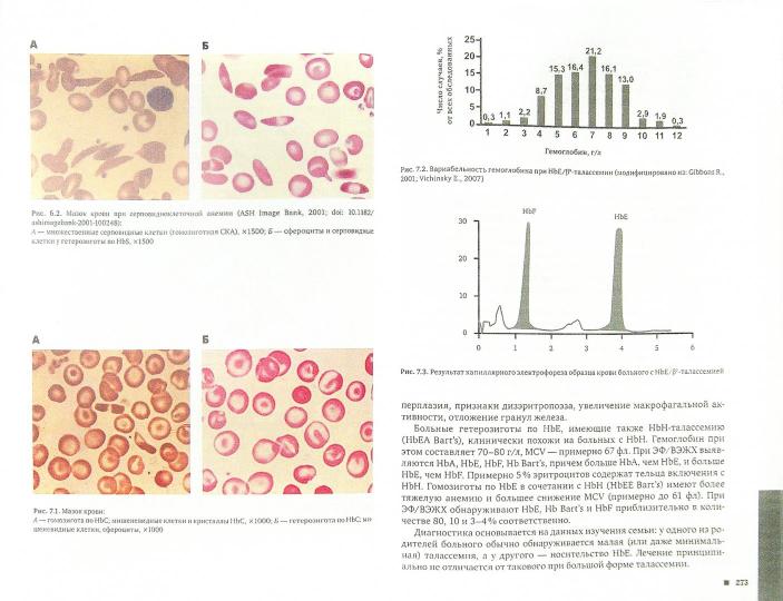 Гемоглобинопатии и талассемические синдромы. Под ред. Румянцева А.Г.