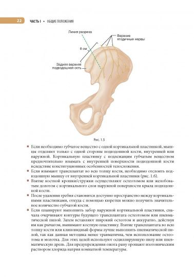 Оперативная ортопедия по Кемпбеллу / С. Терри Кэнел, Джеймс Х. Bite, Frederik M. Azar ; par. с англ. под ред. H. В. Загороднего. —M. : ГЭОТАР-Медиа, 2018. — 584 с. : IL.