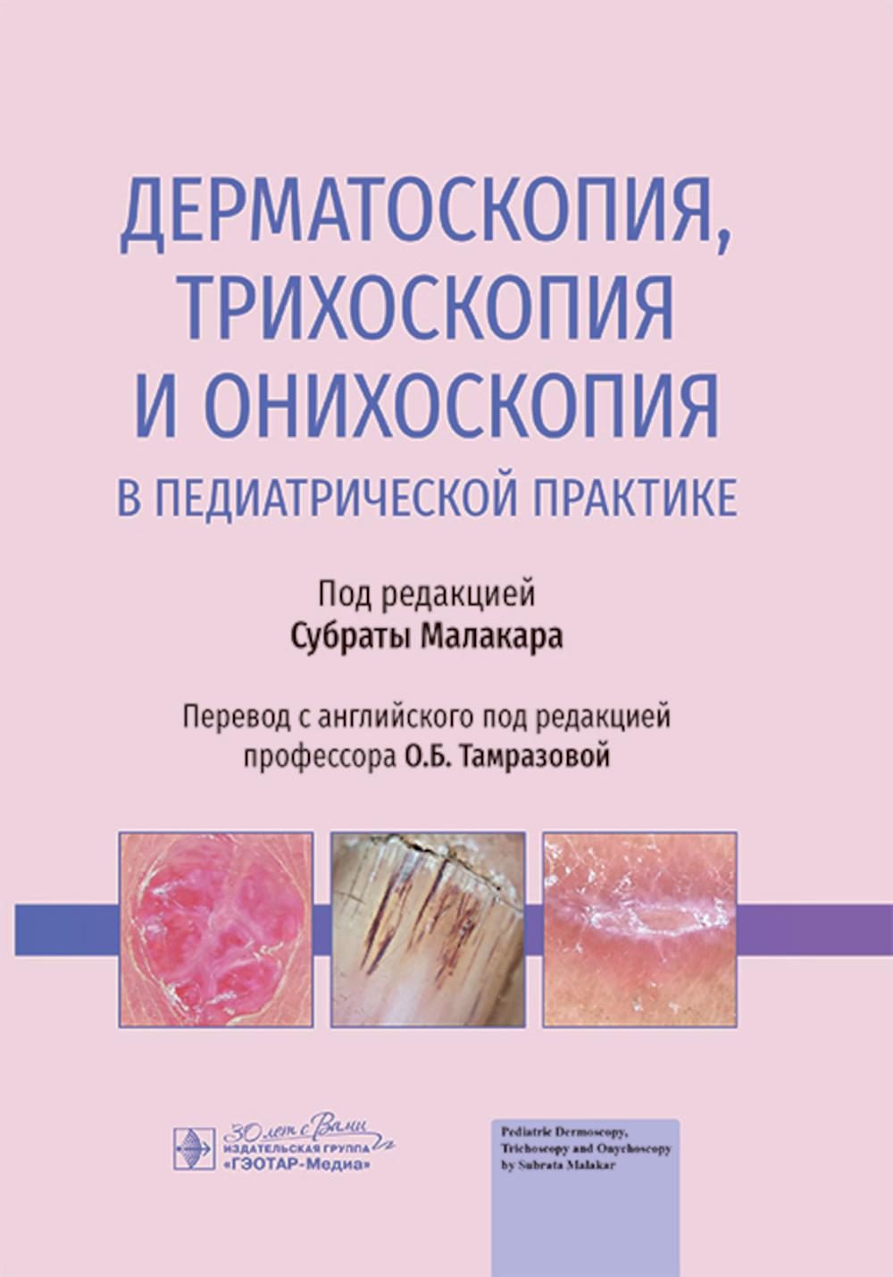 Dermatoscopie, trihoscopie et onioscopie en pratique pédiatrique / под ред. C. Malacara ; par. с англ. под ред. О. Б. Tamrazovoj. — Москва : ГЭОТАР-Медиа, 2024. — 296 с. : IL.