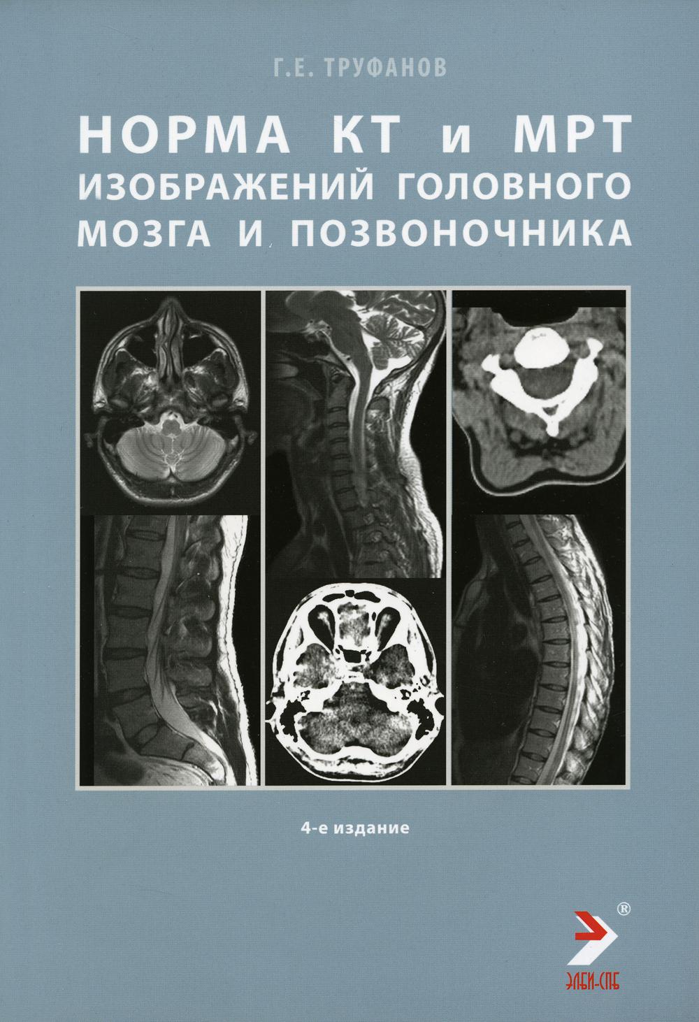 Les normes КТ- и МРТ- изображений головного мозга и позвоночника: atlas изображений. 4-ème jour
