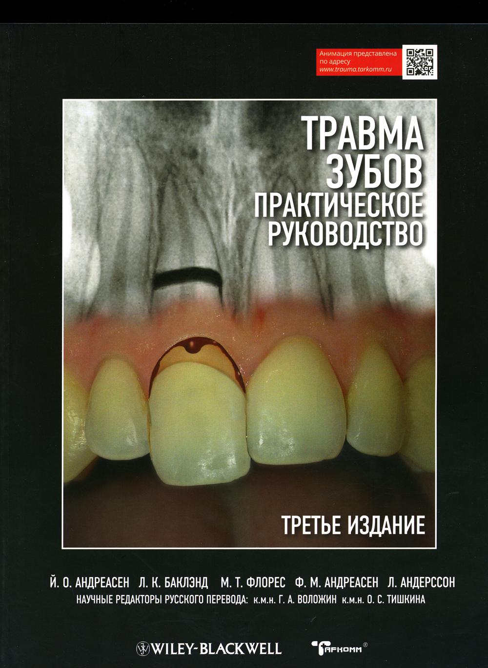 Травма зубов. Практическое руководство - Й.О. Андреасен, Л.К. Баклэнд, М.Т. Flores, F.М. Андреасен, Л. Андерссон (перевод с английского под ред. Г. Во