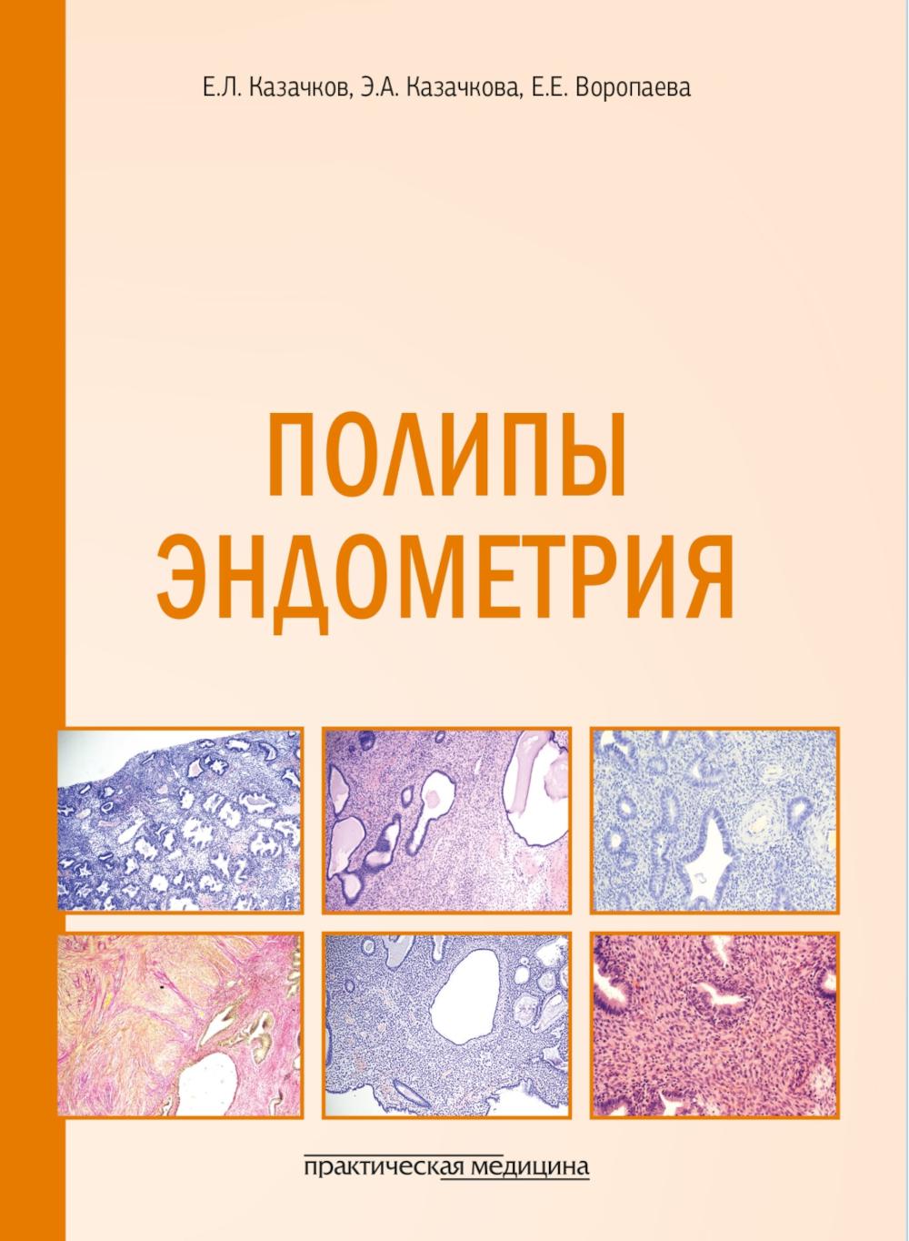 Полипы эндометрия: учебное пособие
