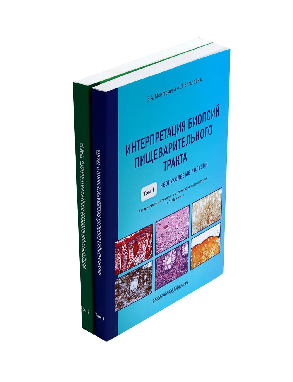 Интерпретация биопсий пищеварительного тракта: В 2-х т. (complexe dans 2-х книг)
