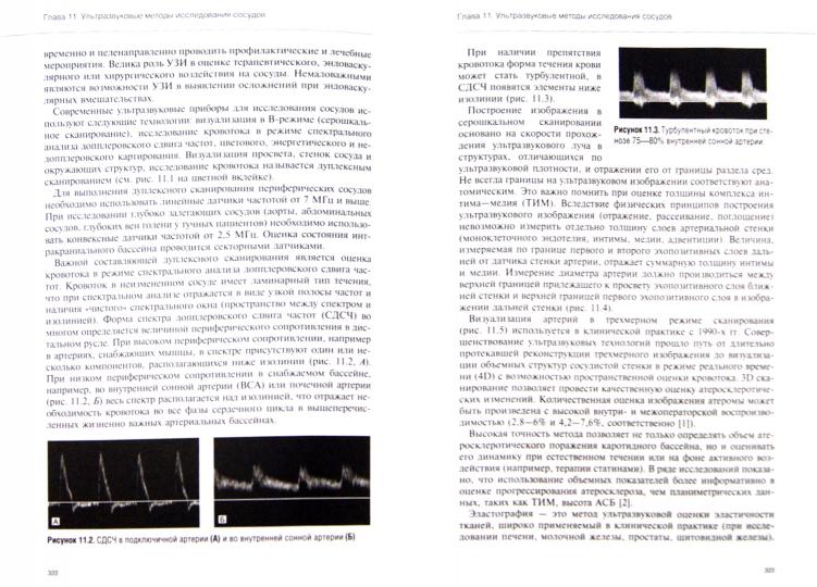 Руководство по кардиологии т2 Методы диагностики