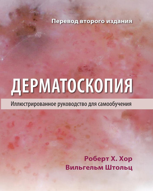 Дерматоскопия. Иллюстрированное руководство для самообучения