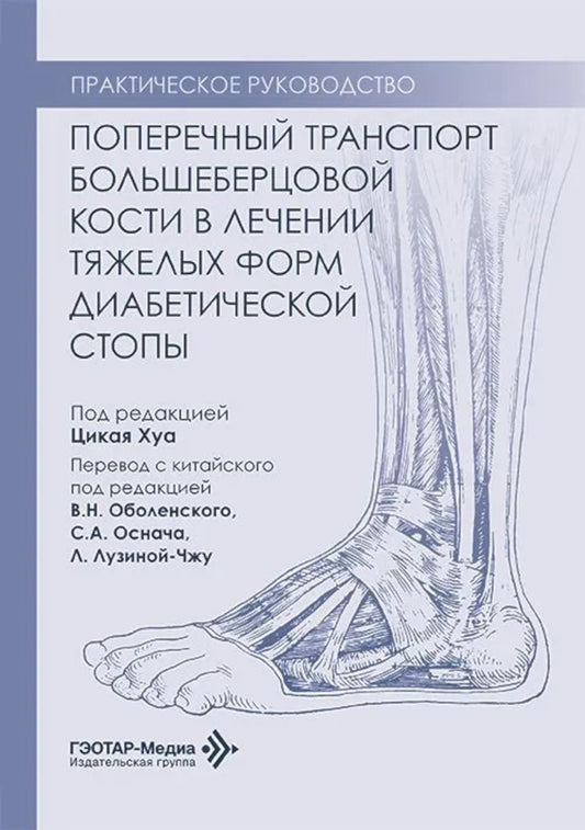Поперечный транспорт большеберцовой кости в лечении тяжелых форм диабетической стопы. Практическое руководство
