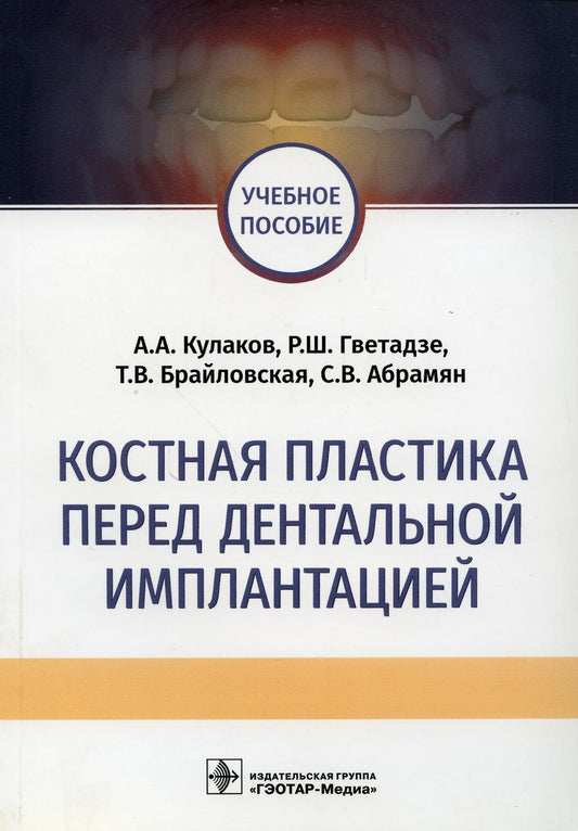 Le coût du plastique avant l'implantation dentaire : учебное пособие / А. A. Кулаков [ и др.]. — M. : ГЭОТАР-Медиа, 2018. — 112 c. : IL.