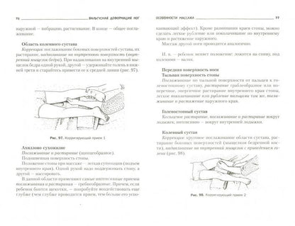 Плоскостопие. Profil et lecture