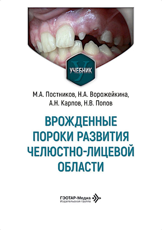 Врожденные пороки развития челюстно-лицевой области: Учебник