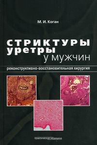 Стриктуры уретры у мужчин. Реконструктивно-восстановительная хирургия