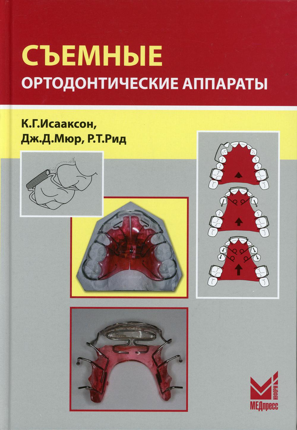 Съемные ортодонтические аппараты. 3-е изд