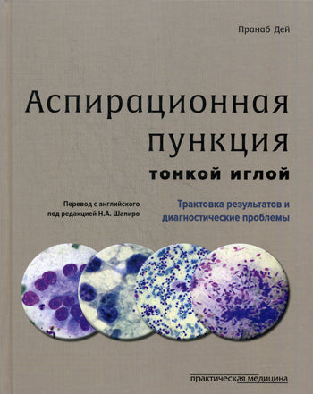 Аспирационная пункция тонкой иглой. Трактовка результатов и диагностические проблемы. Дей Пранаб