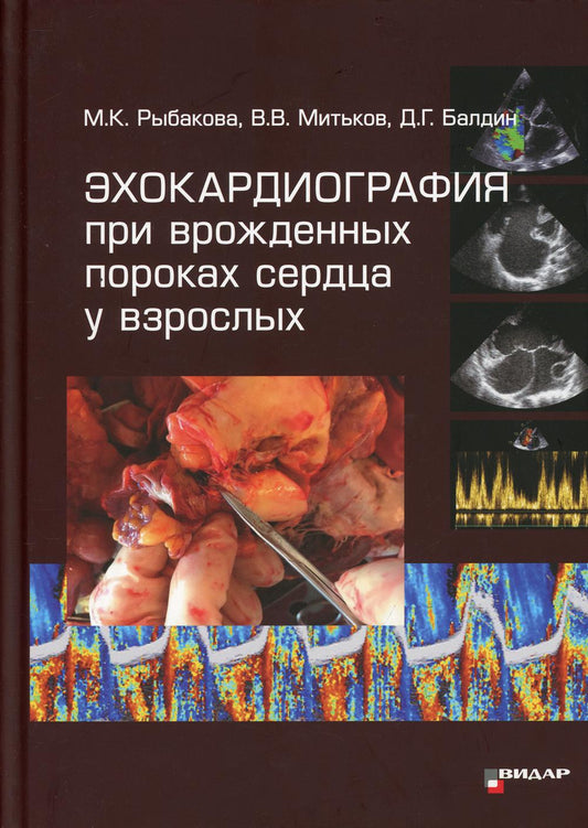 L'échographie des personnes se trouvant à l'intérieur de votre maison