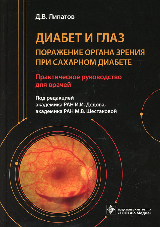 Le diabète et le verre. Поражение органа зрения при сахарном диабете : практическое руководство для врачей / Д. В. Липатов ; под ред. И. И. Дедова, М. В. Шестаковой. — Москва : ГЭОТАР-Медиа, 2021. — 352 с. : IL.