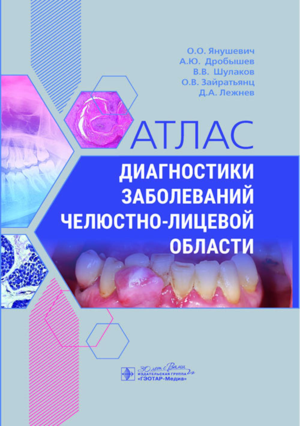 Атлас диагностики заболеваний челюстно-лицевой области / О. О. Янушевич, А. Ю. Дробышев, В. В. Шулаков [и др.]. — Москва : ГЭОТАР-Медиа, 2024. — 248 с. : ил.