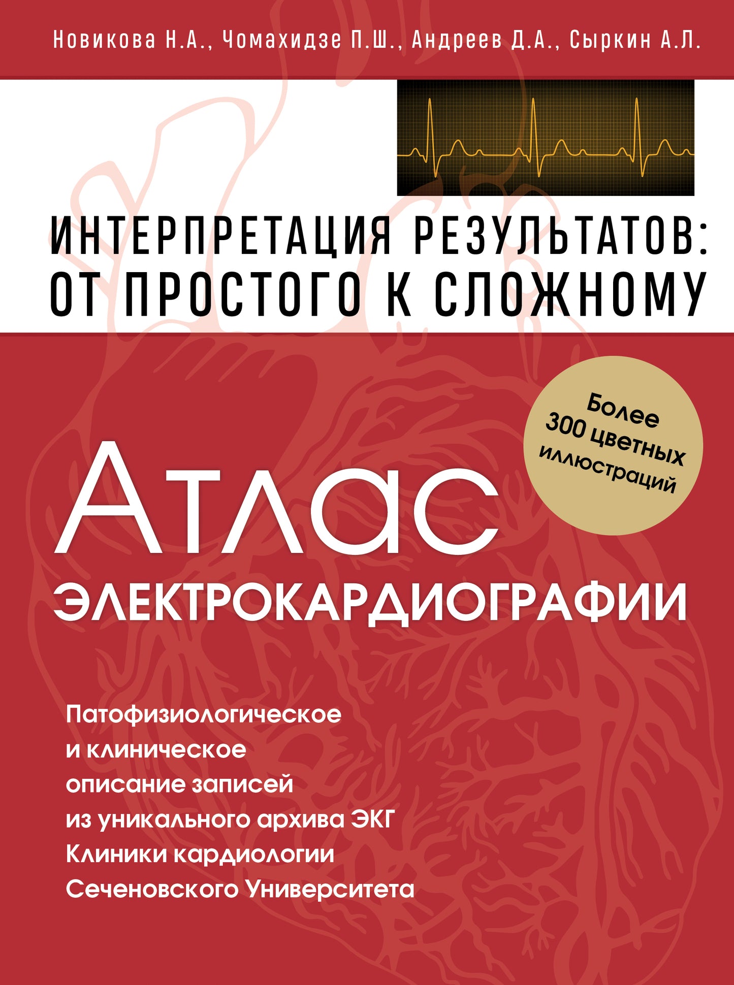 Атлас электрокардиографии. Интерпретация результатов: от простого к сложному