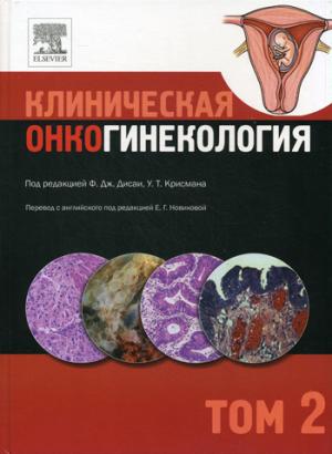 Клиническая онкогинекология. В 3 т. Т. 2. Под ред. Ф.Дж. Дисаи, У.Т. Крисмана