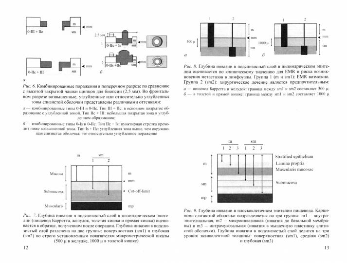 Справочник классификаций, применяемых в эндоскопии желудочно-кишечного тракта (ЖКТ): Учебно-методическое пособие. 3-е изд., испр. и доп
